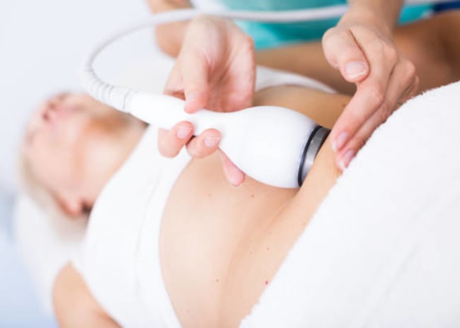 1, 2 o 3 sedute di criolipolisi da 20 minuti -53%