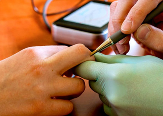 EAV Intolerance Search 300 alimenti -70%