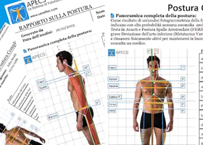 Analisi posturale Daniel Michieletto Massofisioterapista Pordenone -50%