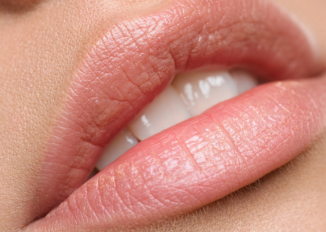 hydralips labbra farmalaser garbatella roma -30%