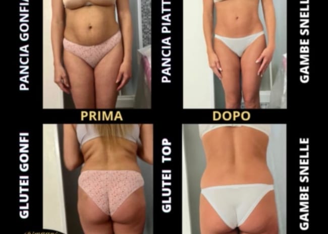 3 o 6 sedute di trattamenti dimagranti da 20 minuti a scelta -84%