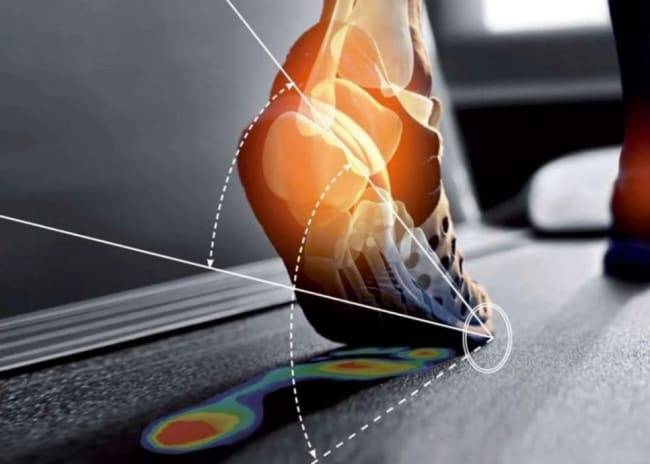 Esame baropodometrico e podoscopico -73%