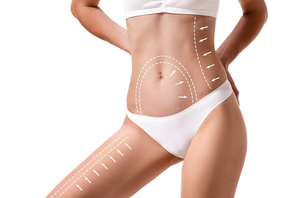 Liposuzione Laser Torino EsteticAmica -53%