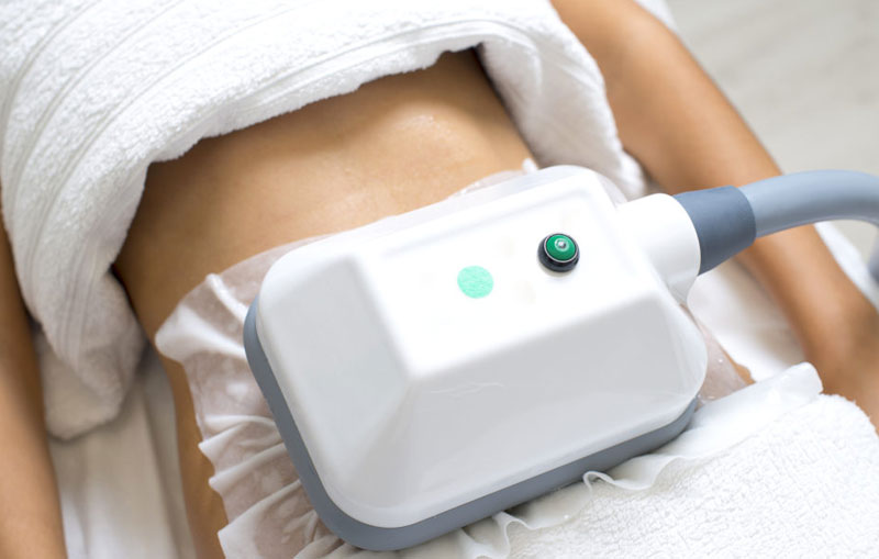 Criolipolisi Torino EsteticAmica -80%