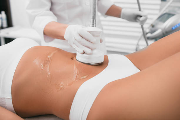 1 o 2 sedute di cavitazione ultrasonica da 20 minuti -77%