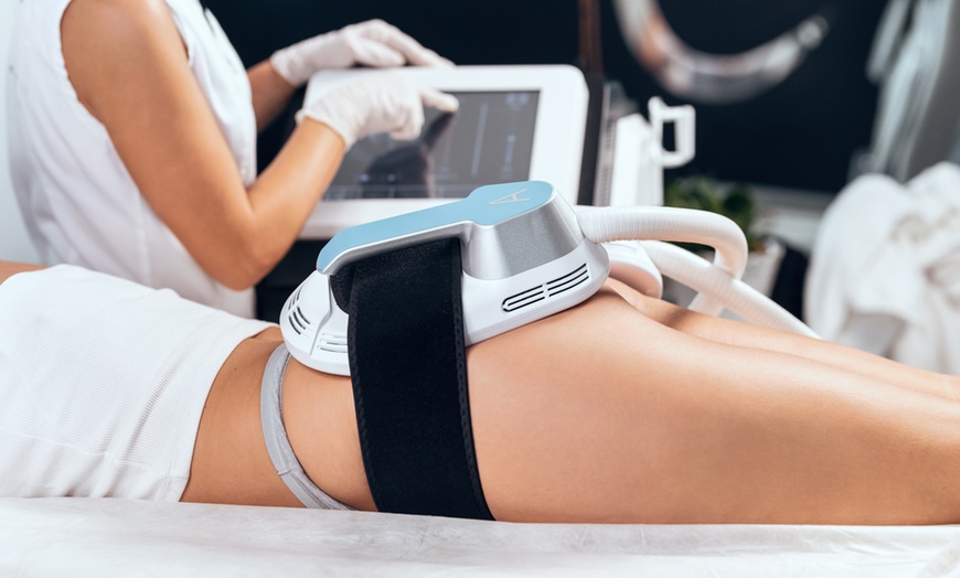 1 o 2 sedute di rimodellamento con EMSculptor -84%