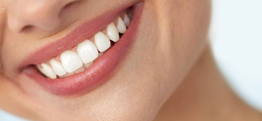 1 o 2 sedute di sbiancamento dentale led cosmetico -70%