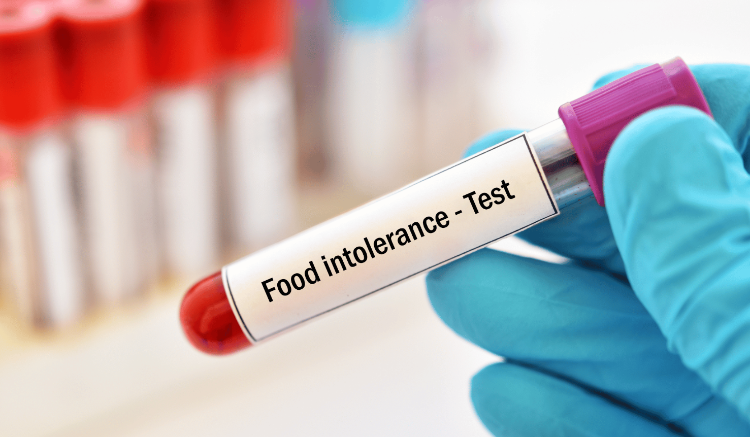 EAV Intolerance Search 160 alimenti -64&