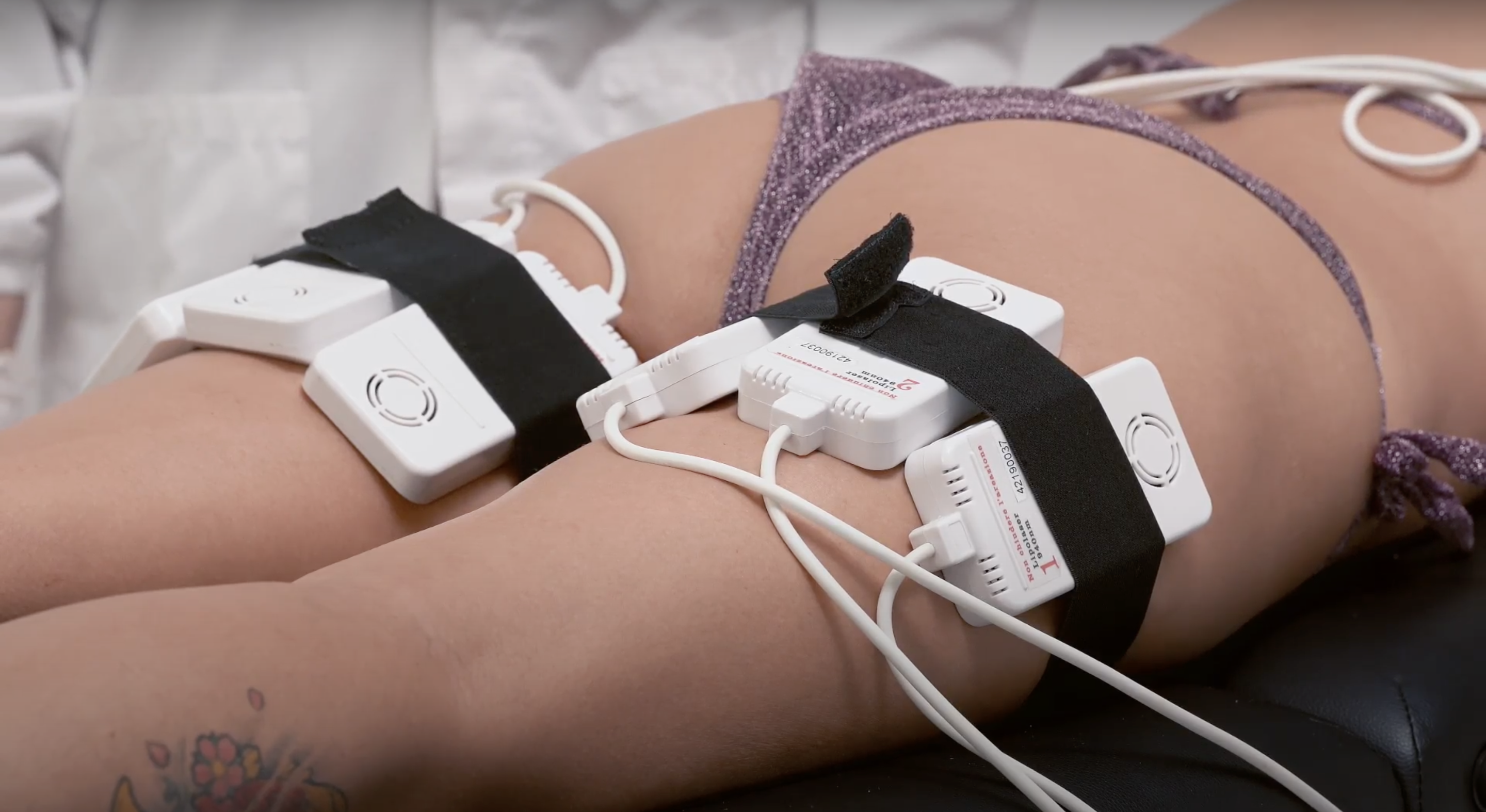 6 o 9 sedute di lipolaser medicale Biomed