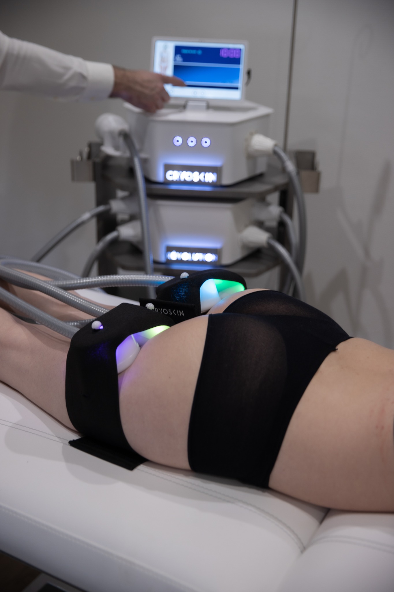 1 o 2 sedute di criolipolisi -65%