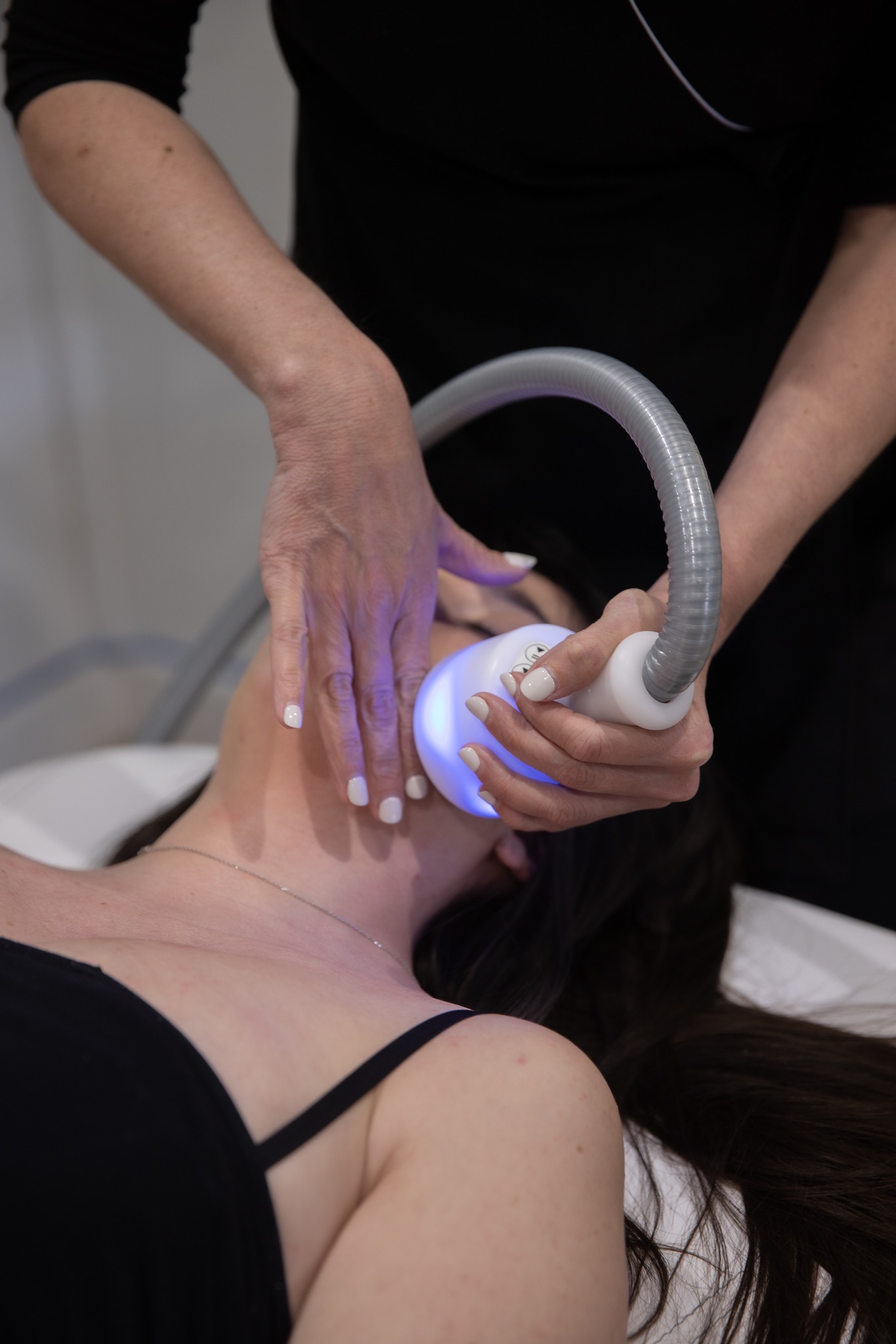 1 o 3 sedute di cryolift -58%