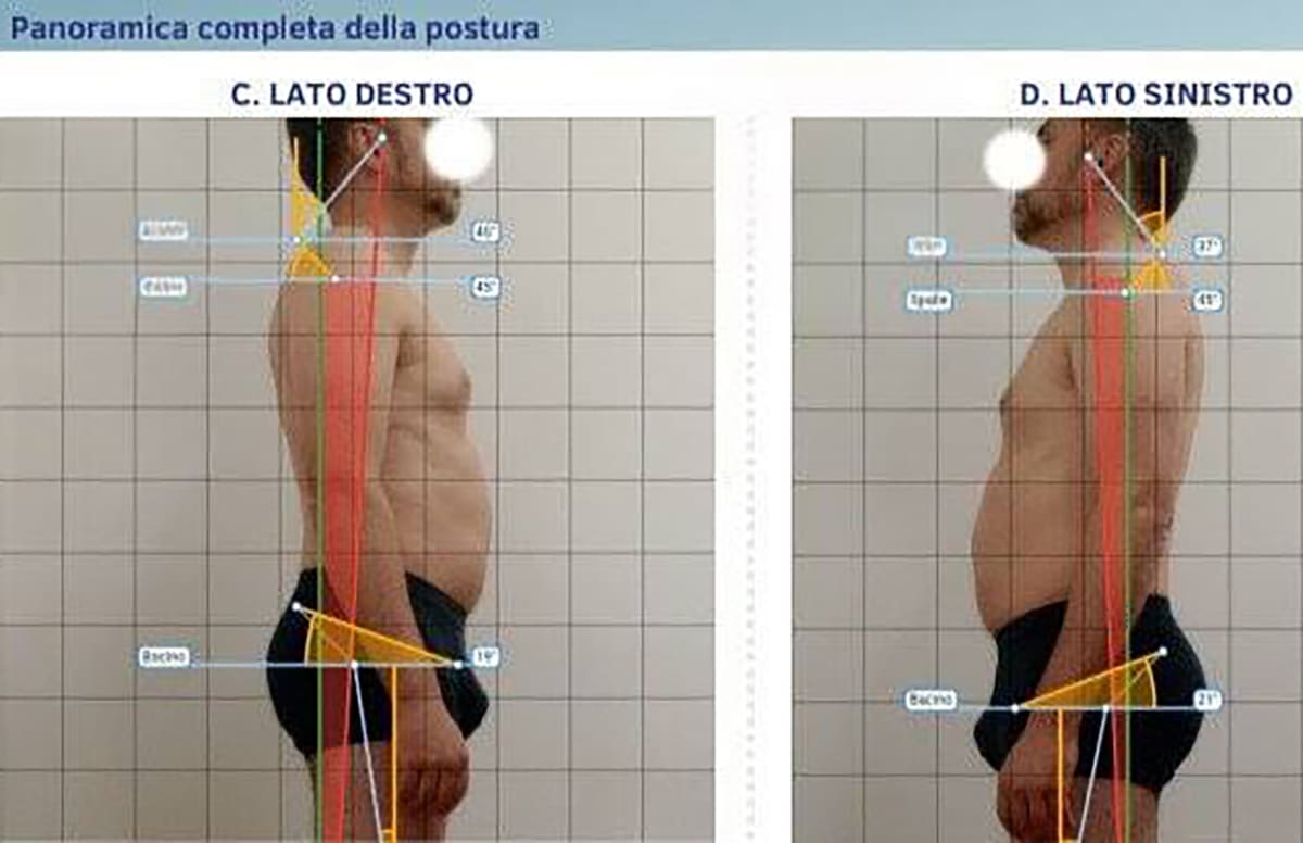 Daniel Michieletto Massofisioterapista - Pordenone