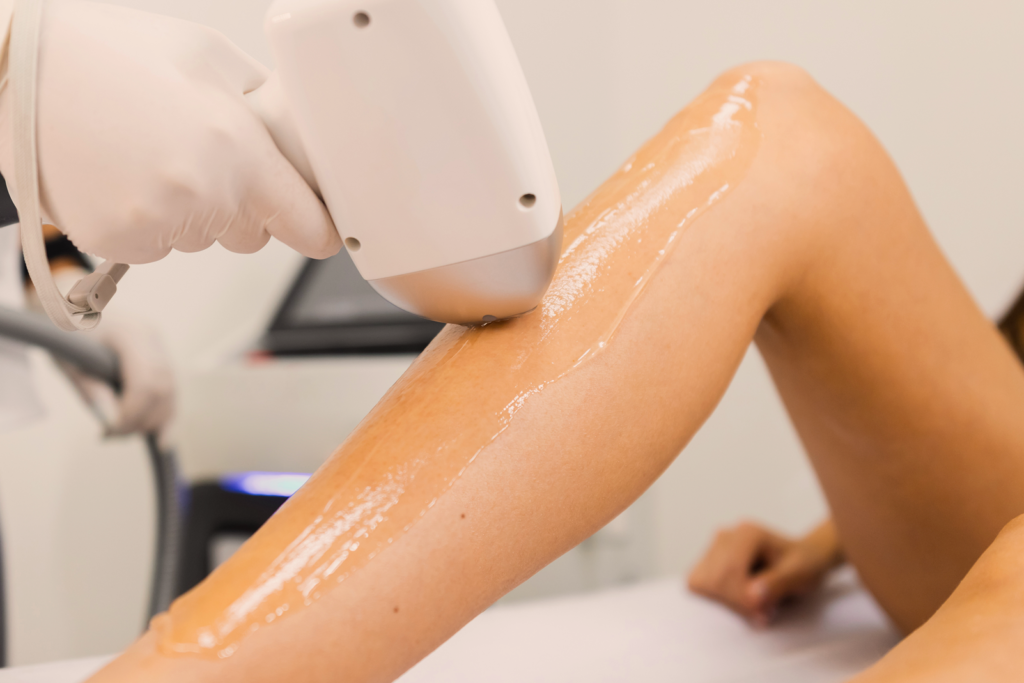 epilazione laser esteticamica torino -86%