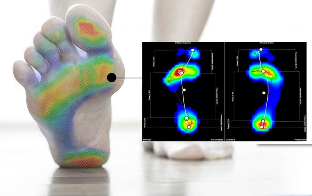 baropodometrico plantare ortopedico centro del piede roma -78%