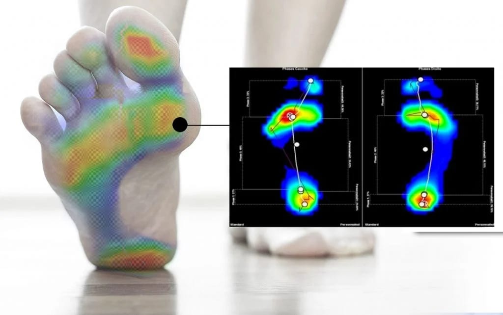 Esame baropodometrico e podoscopico -73%