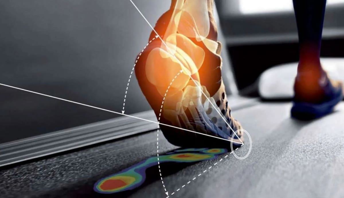 Esame baropodometrico e podoscopico -73%