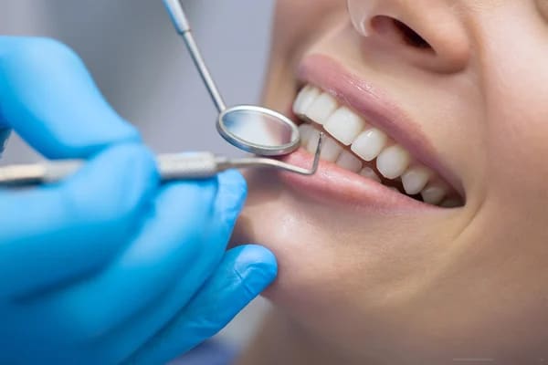 Visita Odontoiatrica, pulizia Professionale e Sbiancamento