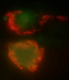 HCMV Assembly complex in HFF cells, Cy5 stained GOLPH (red) and Cy2 stained viral tegument protein pp28 (red)