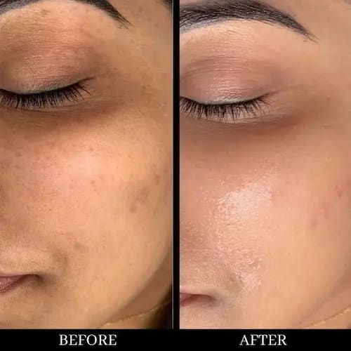 Facial treatment before after - Best unisex salon in Gaya