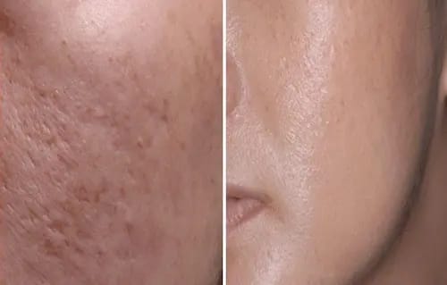 Skin treatment in Gaya