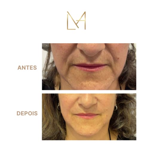 Resultado 1 para Bigode Chinês