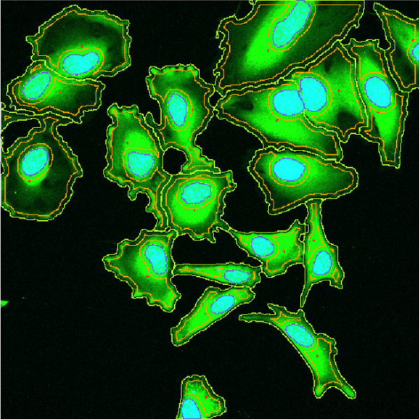 SS2000 live-cell imaging and segmentation