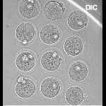Long-term,multi-dimensional livecell imaging