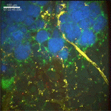 in vivo imaging