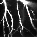 Real Time Calcium Imaging