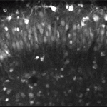 Real Time Calcium Imaging