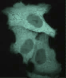 Real Time/Real Color FRET Imaging