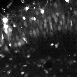 Real Time Calcium Imaging