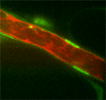 in vivo imaging