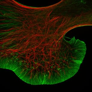 NG108 cell growth cone