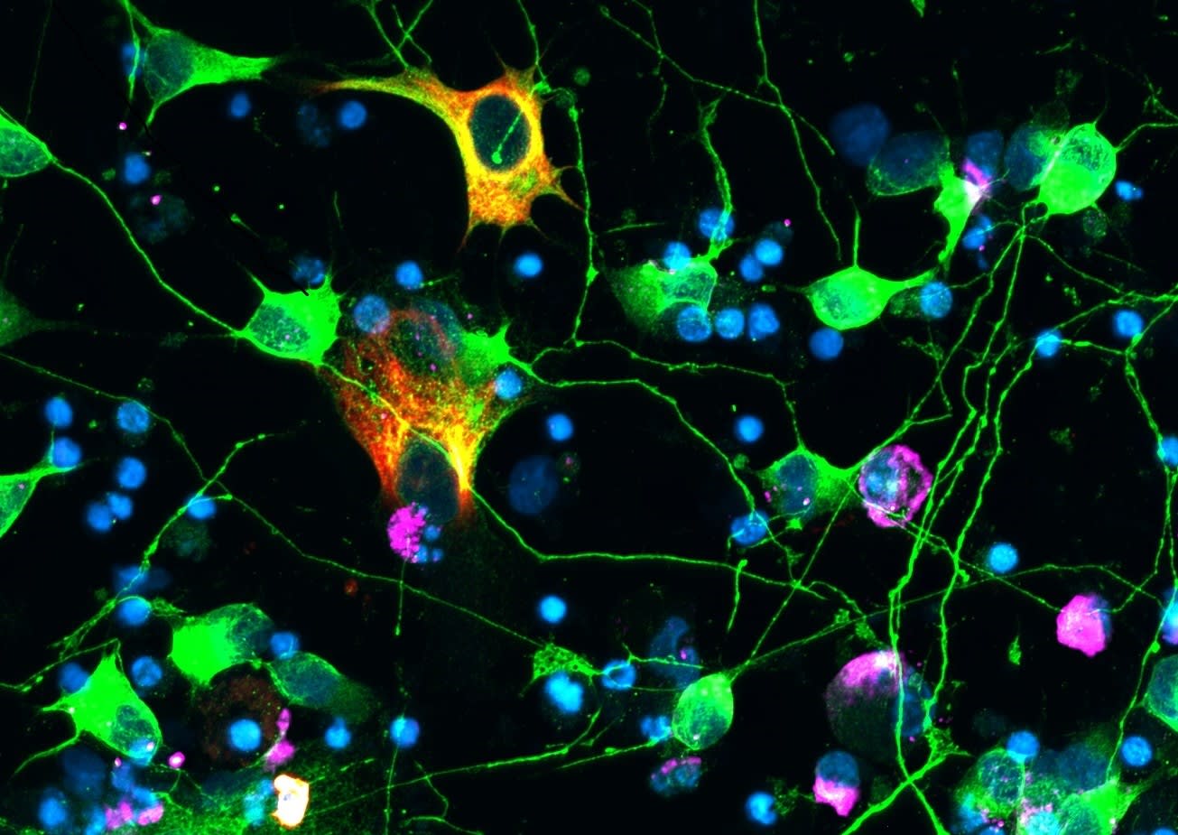 Tri-culture of neurons, astrocytes, and microglia