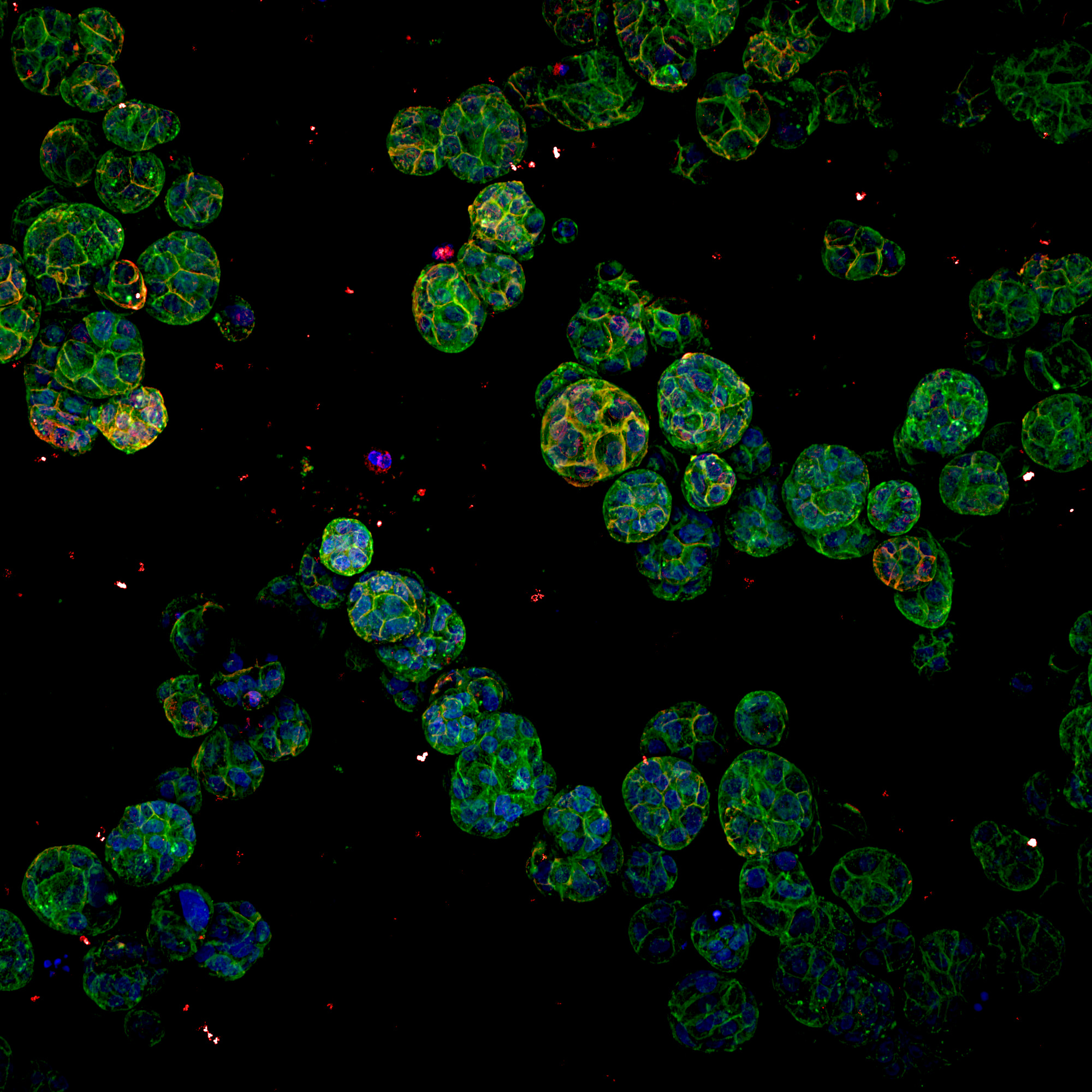 Breast cancer cells under CV8000