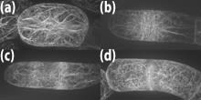 actin microfilaments 