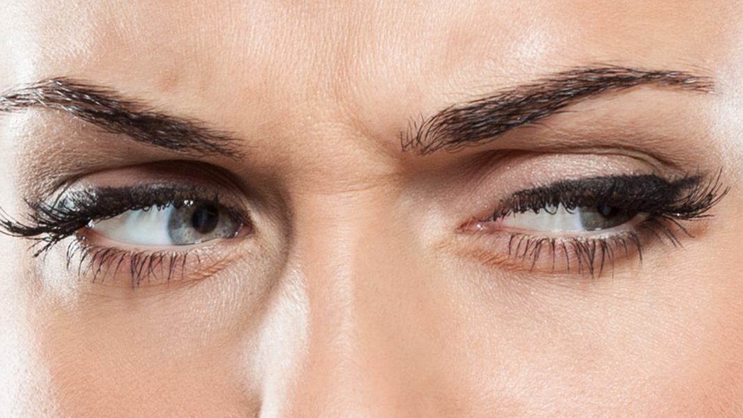 Can furrowing cause wrinkles? Woman furrowing her brow