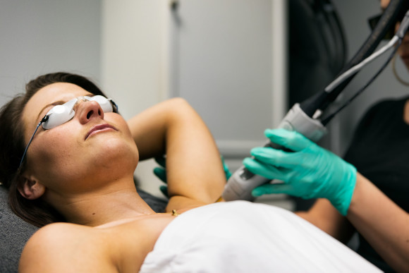 What to Know Before Laser Hair Removal