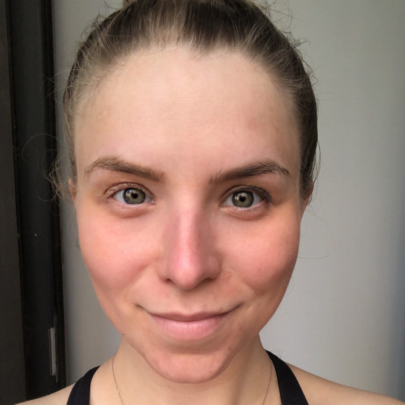 Find Laser Genesis results | Spotlyte