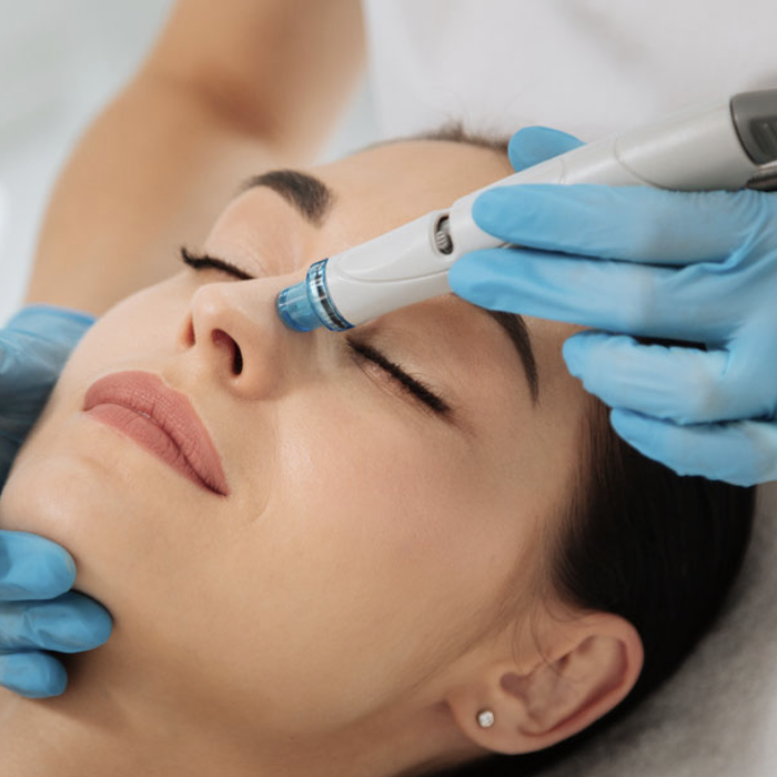 Hydra Facial Offer - ₹ 999/- at Tangles Salon South City -1, Sector 41