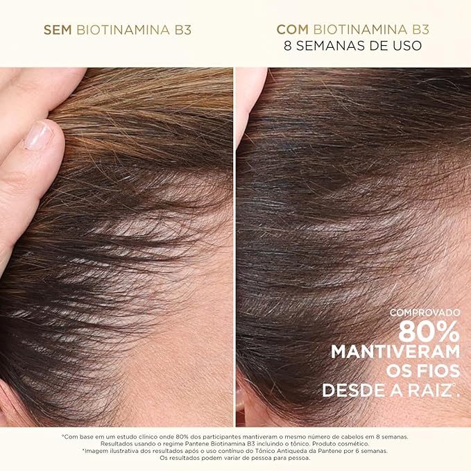 Condicionador Pantene PRO-V Miracles Antiqueda & Nutrição Biotinamina B3 510ml - Imagem 5