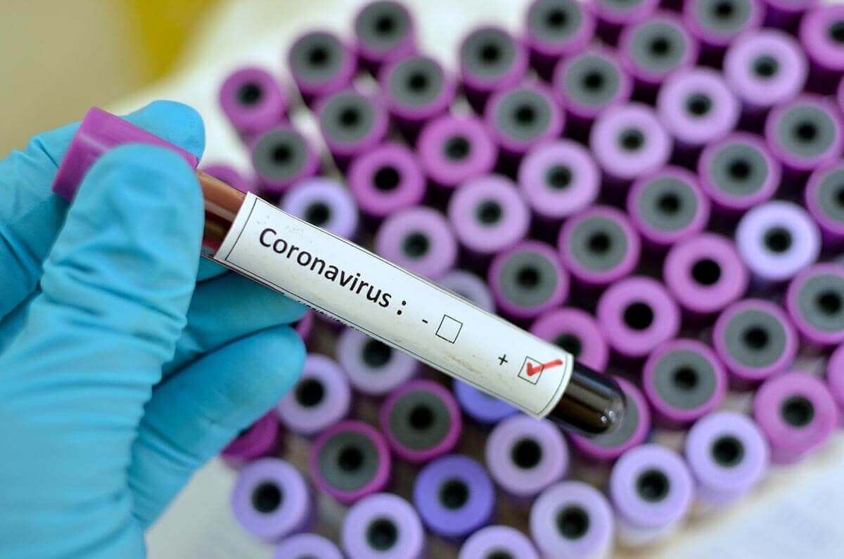 Coronavirus positive