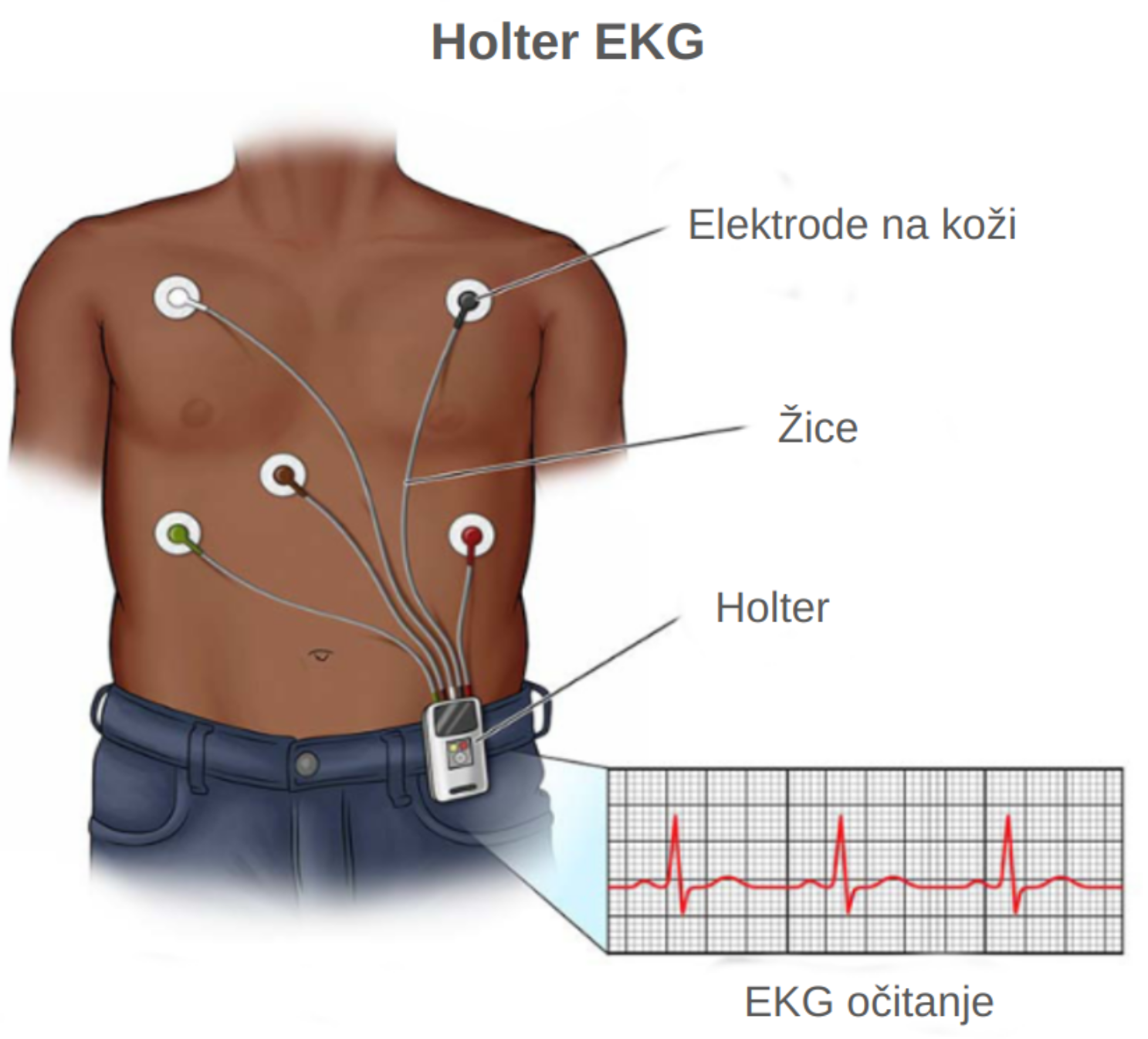 Holter ekg srca postavljen na prsa bilježi aktivnosti srca 24 sata. 