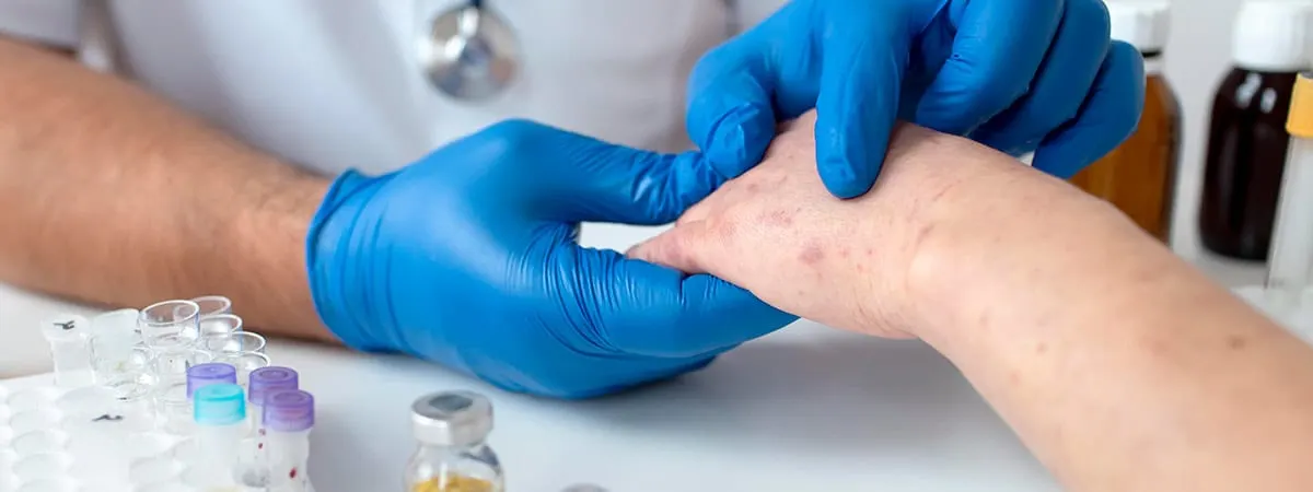 Skin & Sexual Diseases Specialist