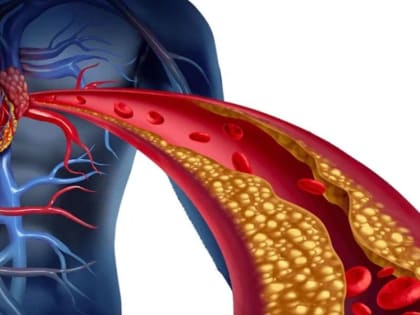 Врачи назвали два симптома, которые появляются незадолго до мгновенной смерти