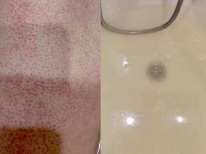 Жители Каменск-Шахтинского рассказали, какой вред им наносит местная вода