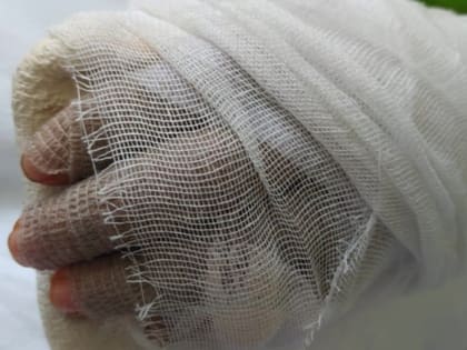 Ростовскому кондитеру во время приготовления теста отрубило кисть