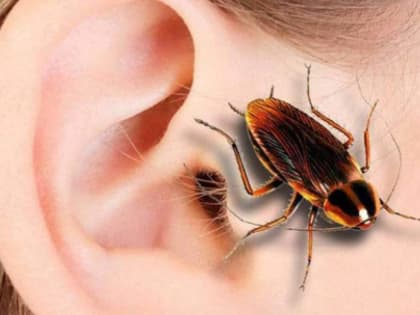 Три месяца с тараканом в ухе прожила ростовчанка