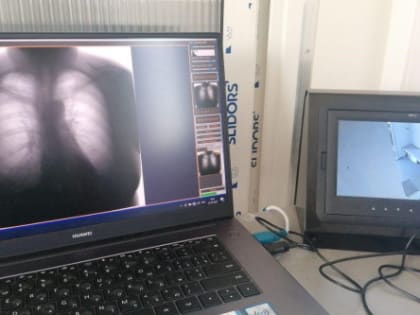 Фтизиатрическая служба Ростовской области пополнилась пятью передвижными комплексами